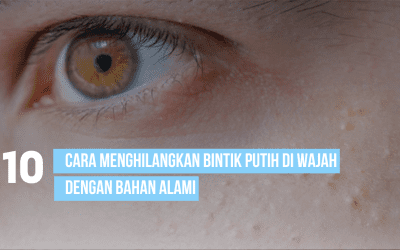 Cara menghilangkan bintik putih di wajah dengan bahan alami