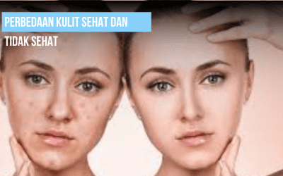 Perbedaan Kulit sehat dan tidak Sehat